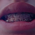 Profile picture of bracesfetish